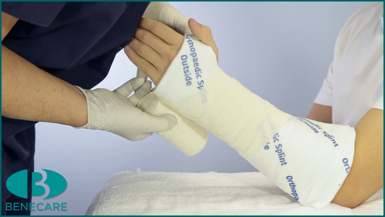 How to Apply a Below Elbow Splint Using Benecast Splint on a Roll