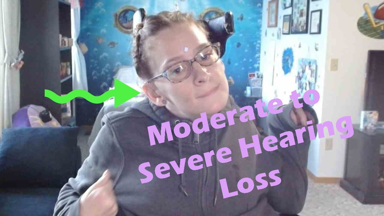 Born with Moderate to SEVERE Hearing Loss...