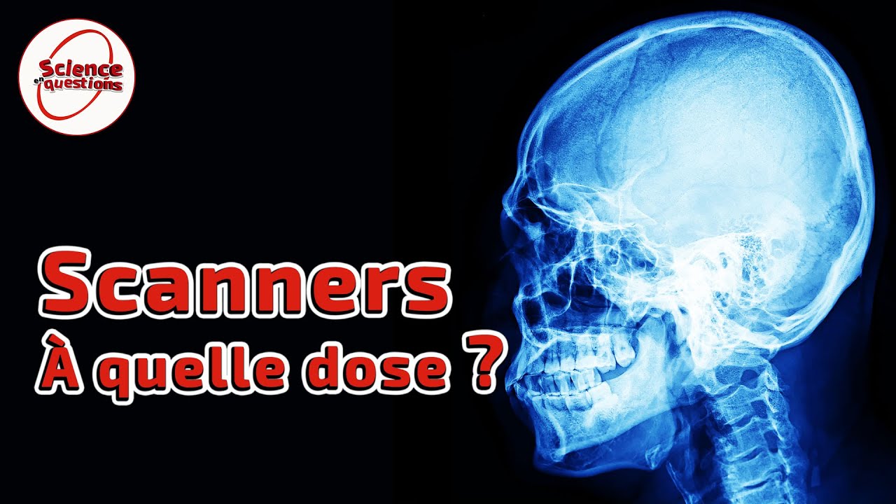 Imagerie médicale : sommes-nous trop exposés aux rayons ? - Science En Questions