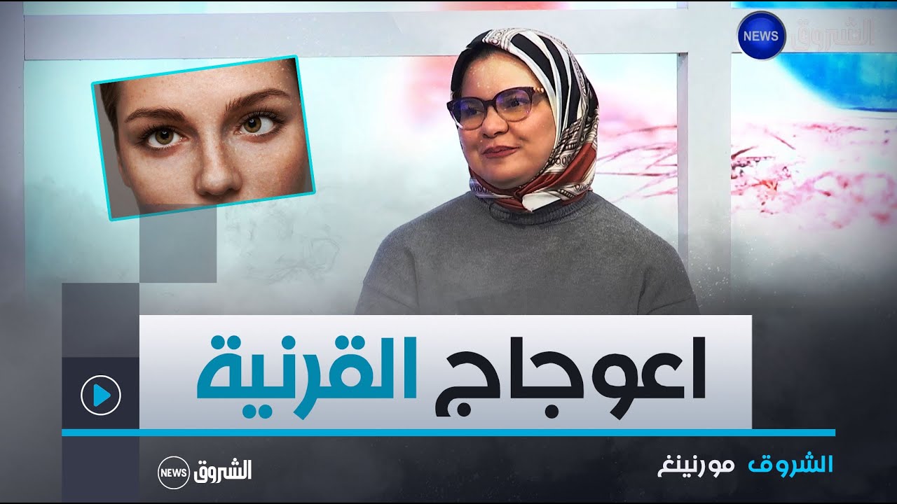 الشروق مورنينغ| اعوجاج القرنية و علاقته بضعف الرؤية