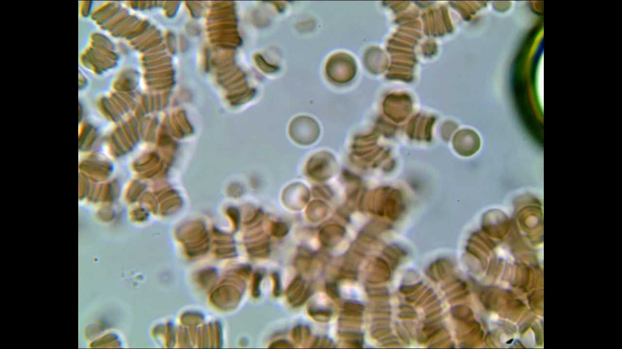 Brunel Microscope SP27D - x1000 Blood - Rouleaux