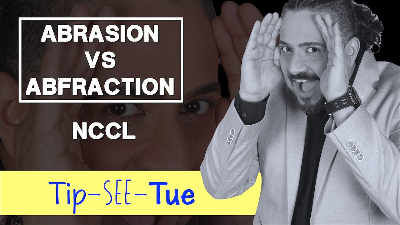 Абразия против абфракции: Tip-See-Tue #learningwithmik