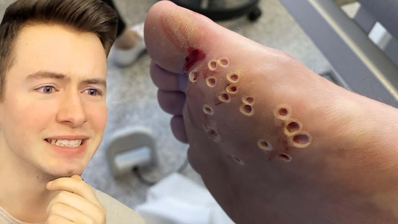Kannst DU dieses VIDEO ZU ENDE SCHAUEN?🤮