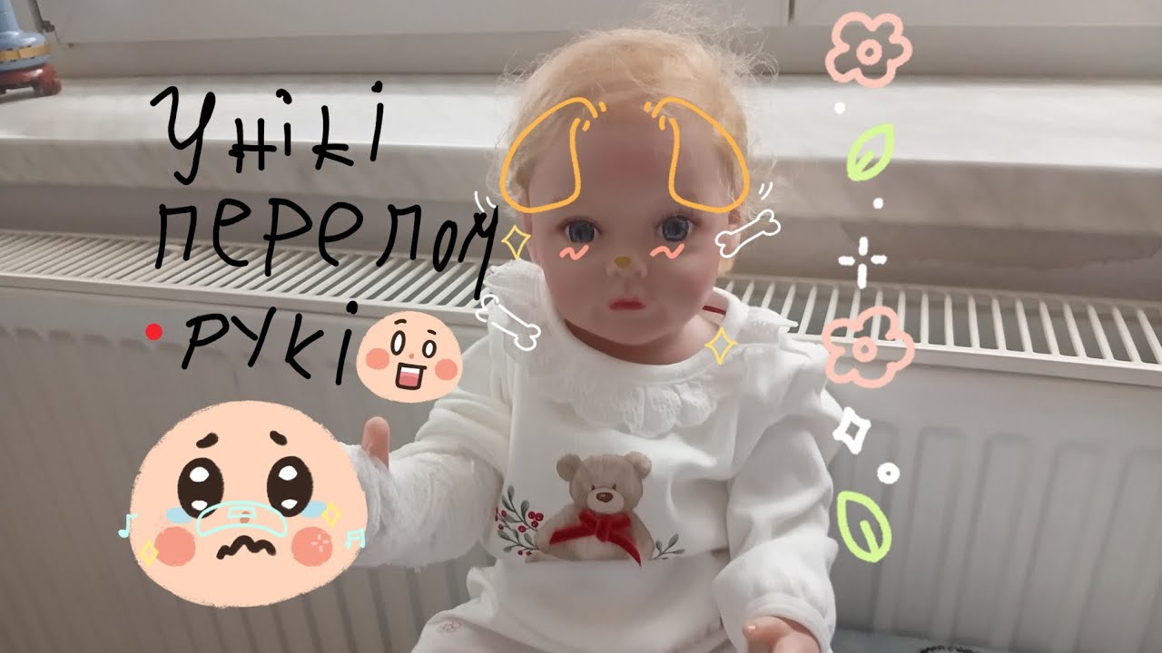 У Ники перелом 😰
