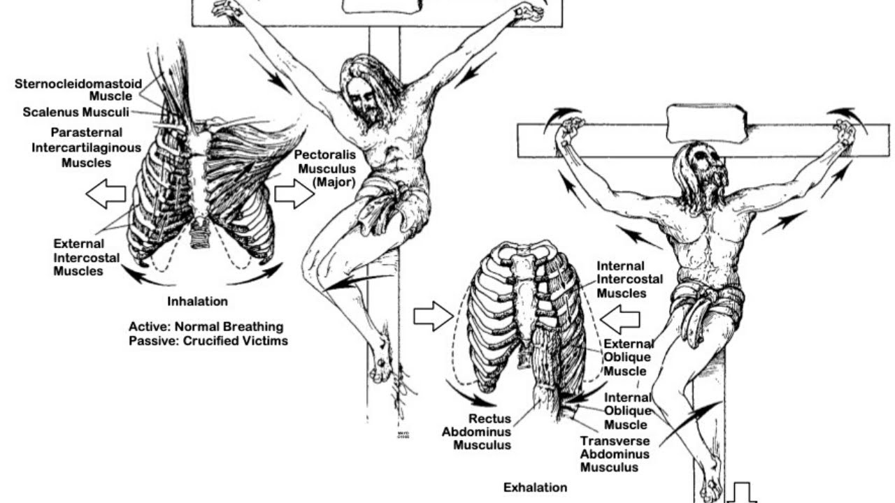 Aspectos Médico-Legais da Crucificação e Morte de Jesus Cristo.