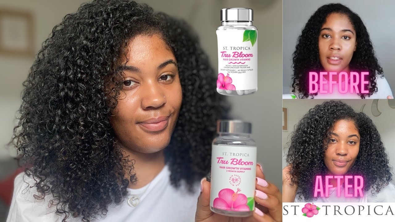 ST. TROPICA Hair Vitamins - Do they really work? My Actual Results | Luana Banks
