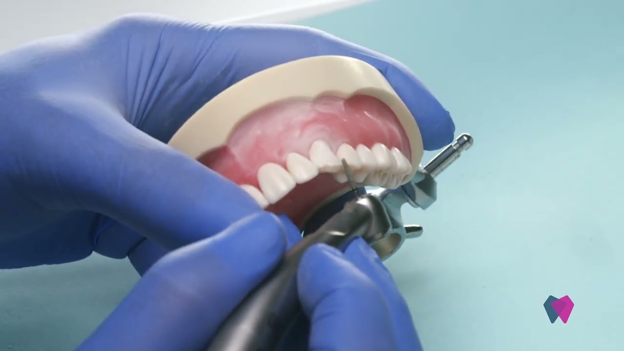 Veneer Prep Step II NeoDiamond 1114.8C Round End Taper