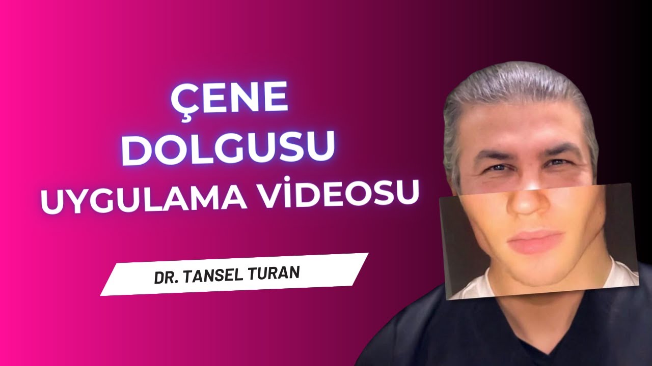 Çene Dolgusu Nasıl Uygulanır?