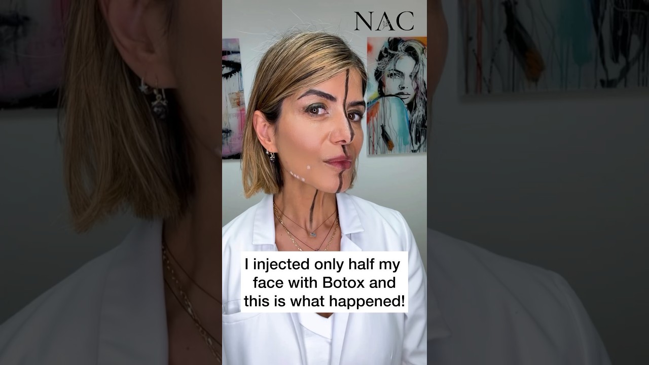 #daobotox #nefertitinecklift #neckbotox #botox #botoxtraining #nefertitinecklift #drbitafarrell