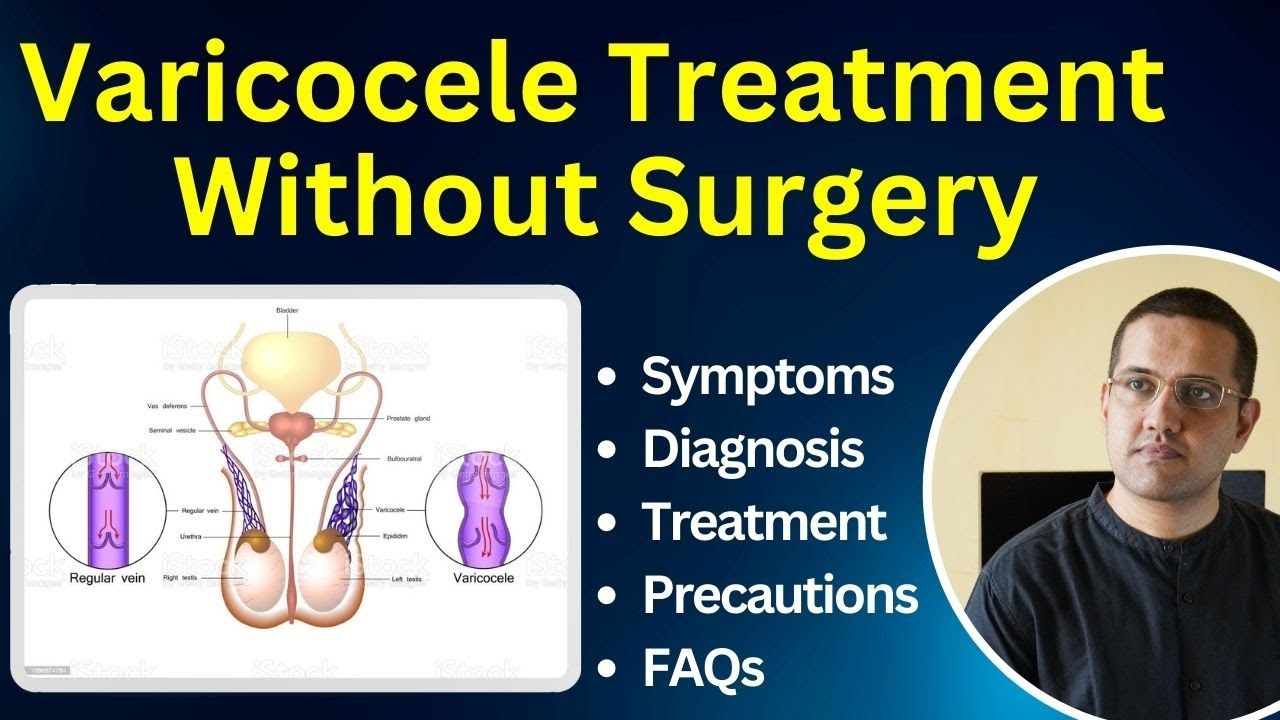 Varicocele | Symptoms, Diagnostic, Best Treatment, FAQ | Dr. Gaurav Gangwani (IR)