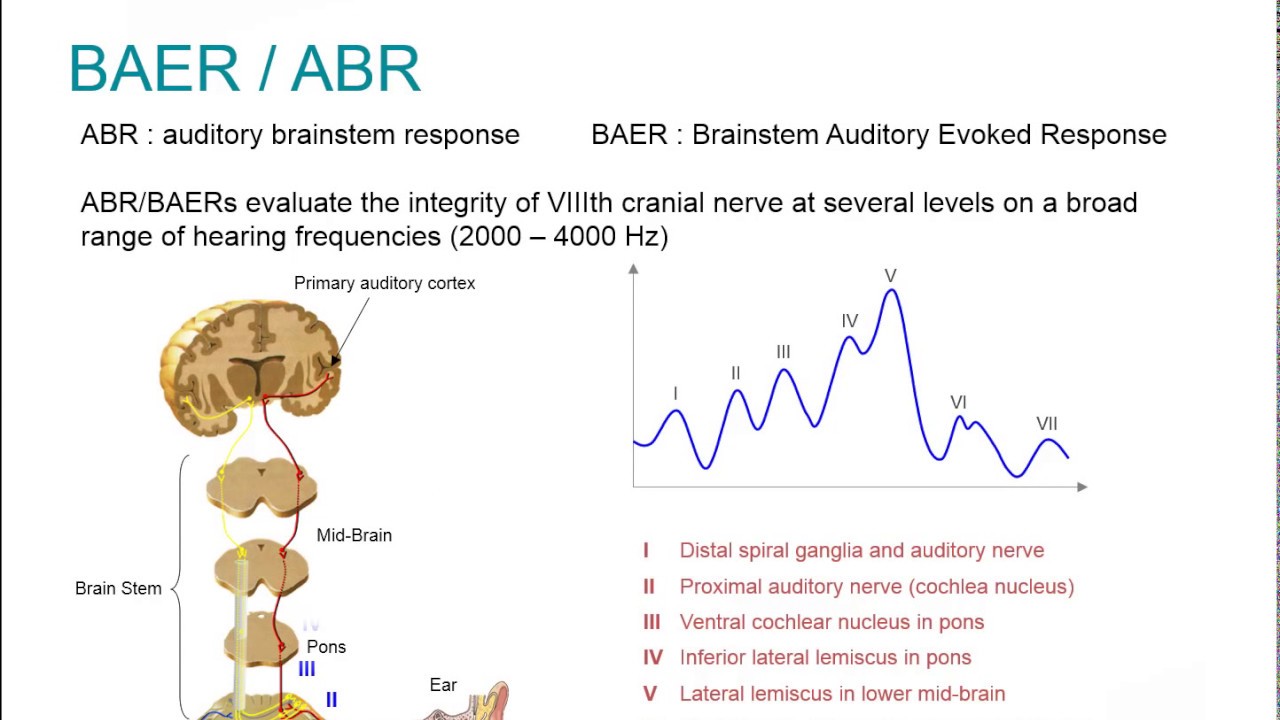 Natus EP Webinar: Clinical Auditory Evoked Potentials
