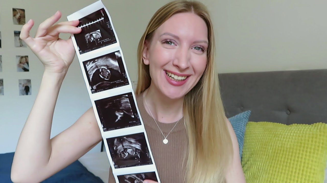 PRIČAKUJEVA!👶🏻❤️ l Prvi znaki nosečnosti in prvo trimesečje