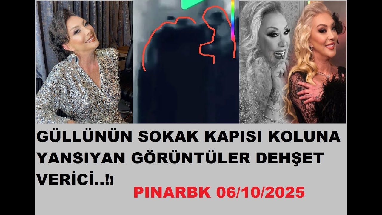 GÜLLÜNÜN SOKAK KAPISI KOLUNA YANSIYAN GÖRÜNTÜLER DEHŞET VERİCİ..!!