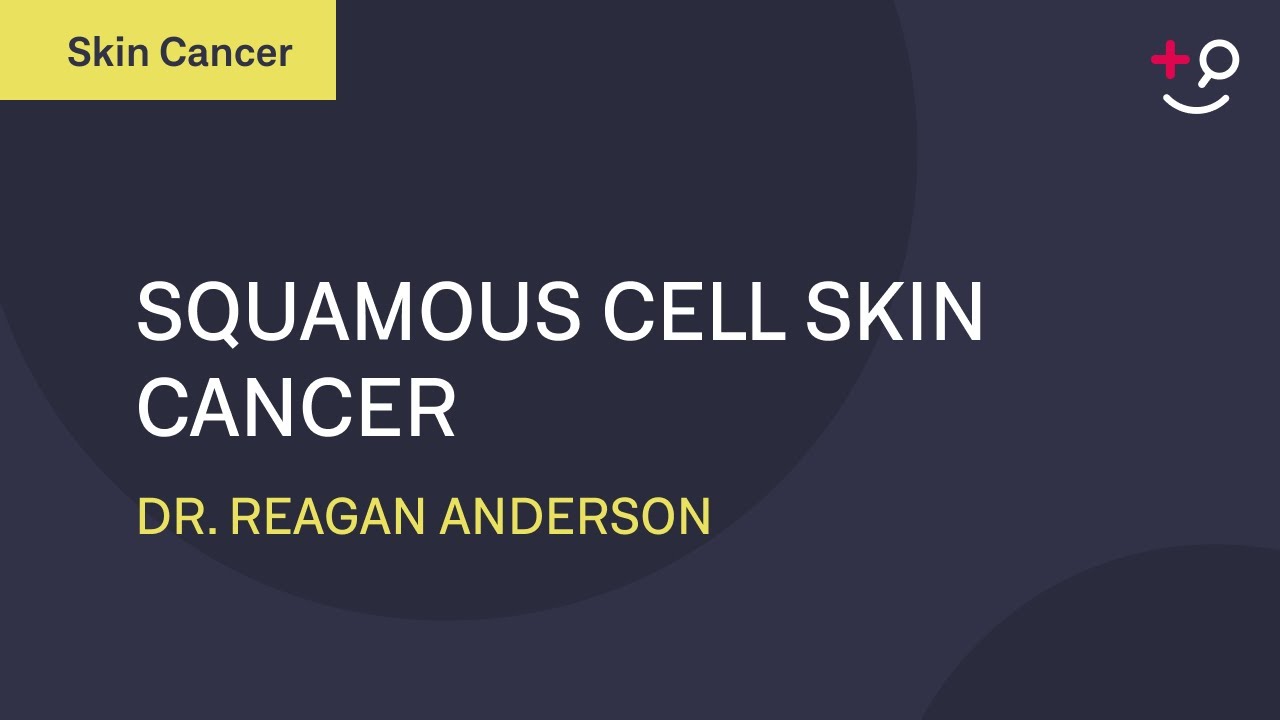 What is Squamous Cell Cancer? - Squamous Cell Cancer Explained [2019] [Dermatology]