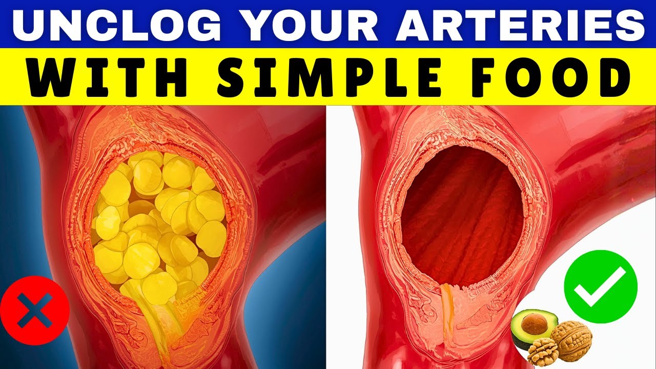 5 Simple Habits for a Stronger Heart and Unclogged Arteries