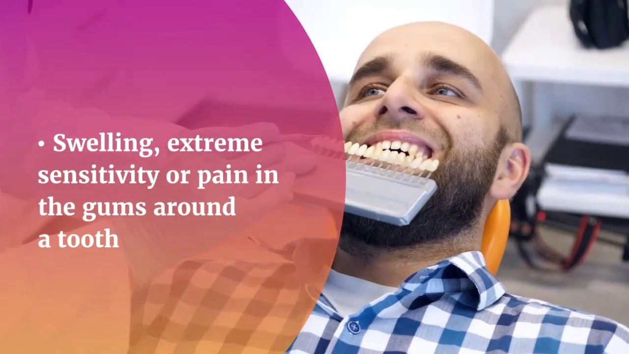 What is a Root Canal Treatment? - Complete Guide  #CareDentalClinic  #DrBinoy #RootCanalTreatment