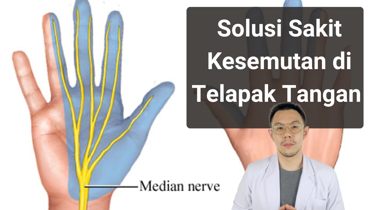 Rehabilitasi dan Penyembuhan Carpal Tunnel Syndrome