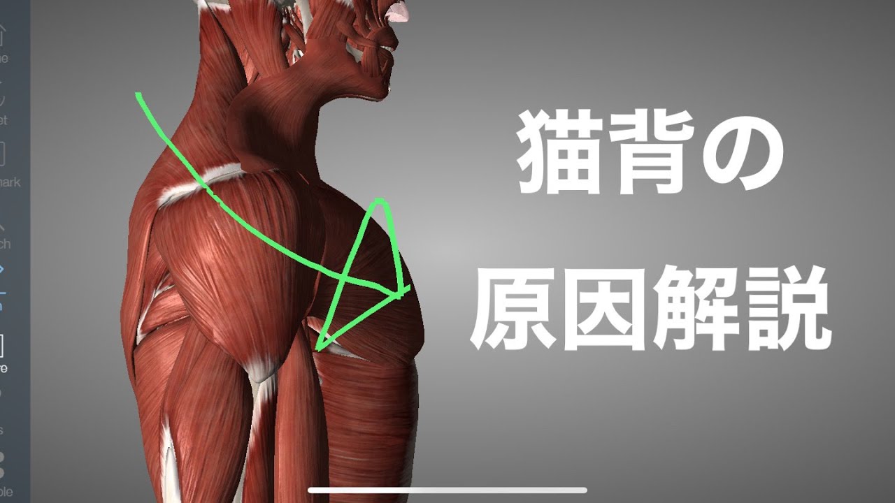 猫背の原因をいろんな角度から解説してみた