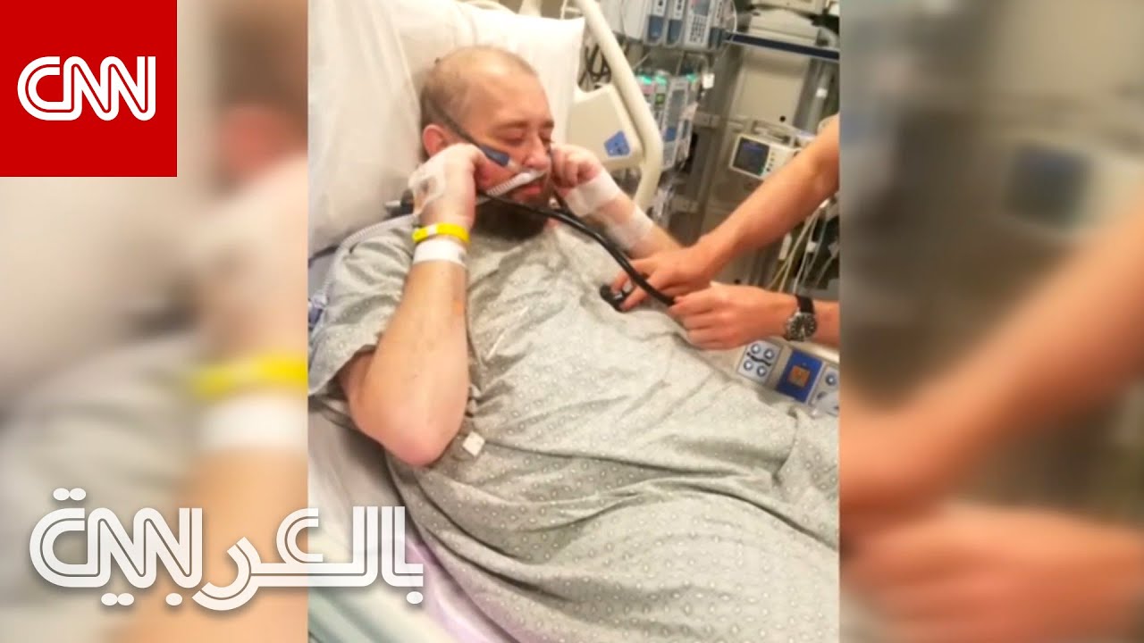 أول شخص يعيش بقلب اصطناعي بالكامل في أمريكا الشمالية