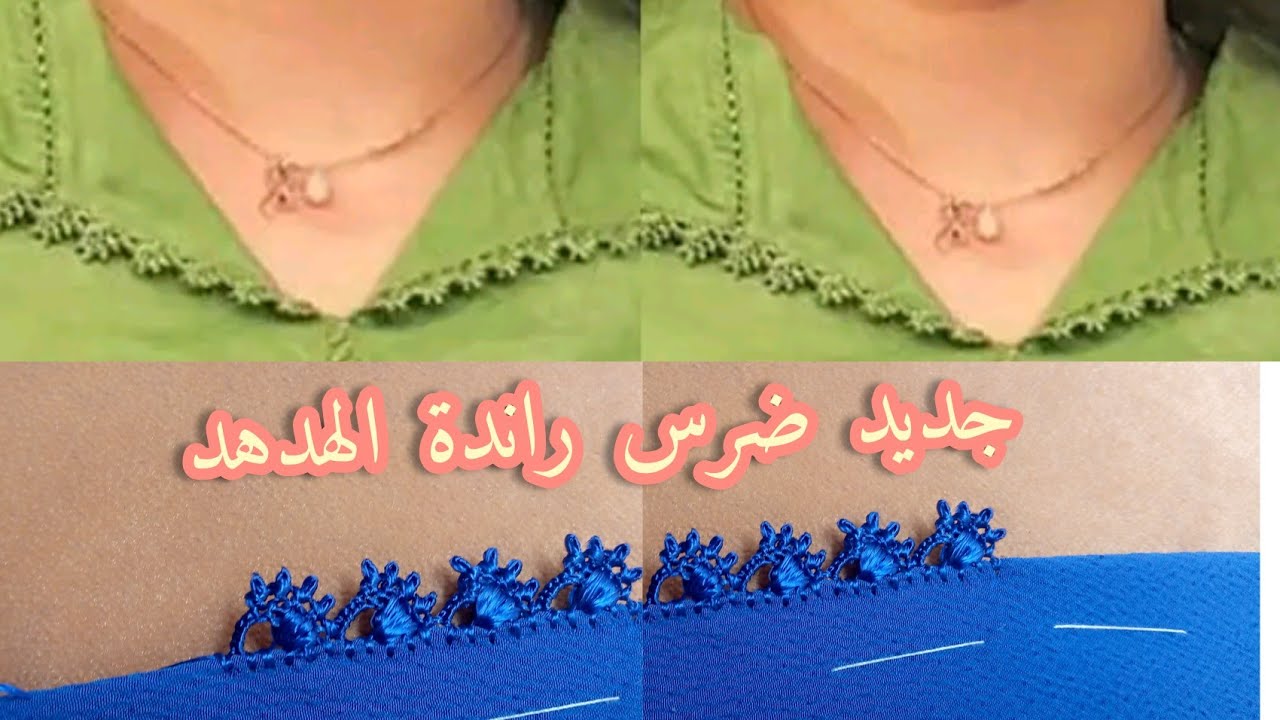 جديد ضرس راندةالهدهد💥ضرس راقي بطريقة بسيطة مع أم محمد امين
