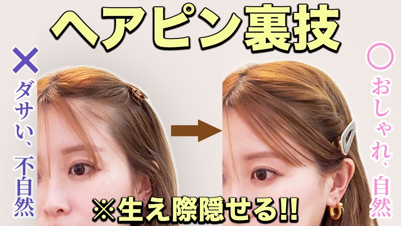 【ヘアピン留め裏技】生え際も隠せる！自然でおしゃれな簡単アレンジ！