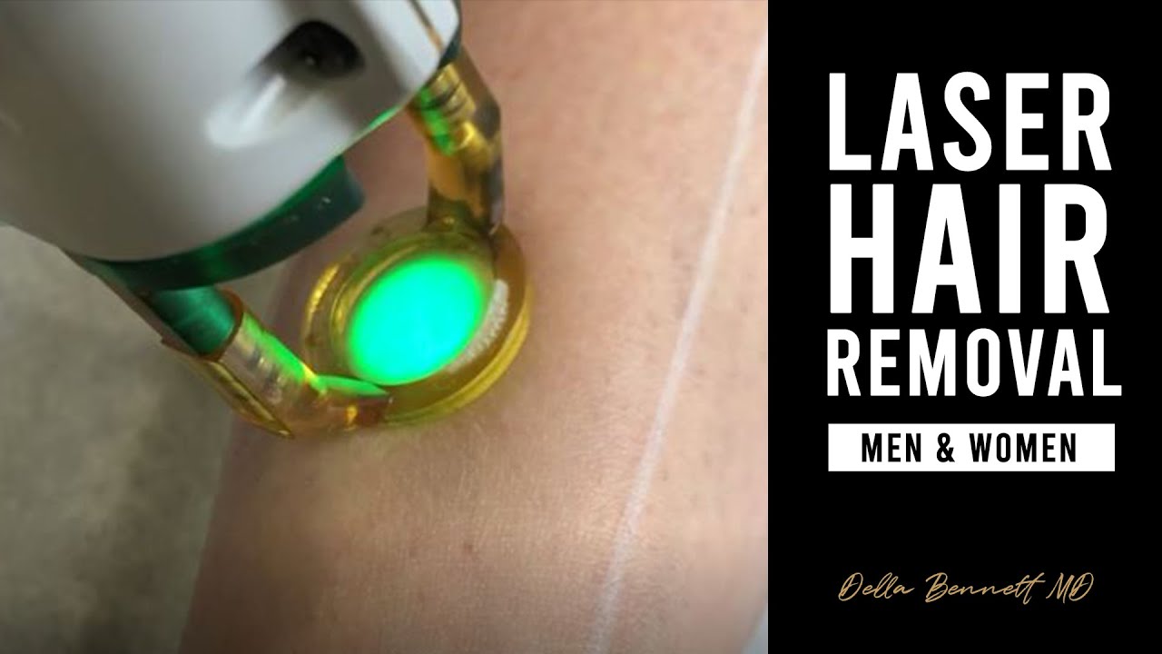Laser Hair Removal (Everything You Need to Know) &middot; Rancho Cucamonga, Chino Hills, Inland Empire