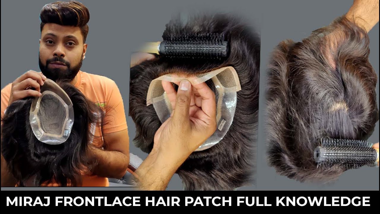 Miraj frontline hair patch full knowledge | frontlace hair patch | permanent hair patch delhi