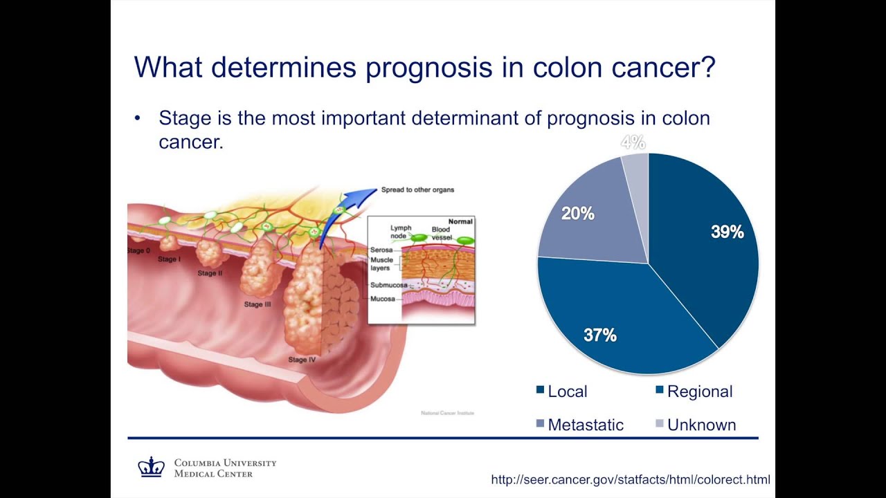 Colon and Rectal Cancer: How much of a problem is it really?