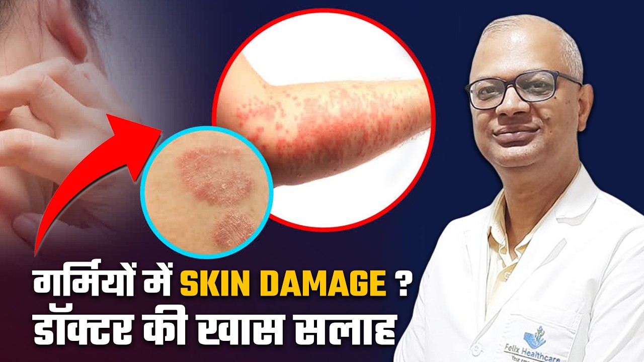 Summer Skin Damage: गर्मियों में Skin Damage को कैसे बचाएं? डॉक्टर की खास सलाह! | Felix Hospital