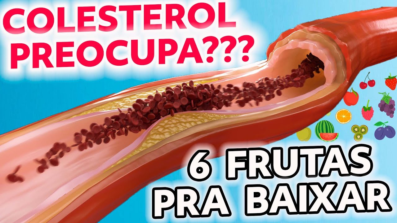 6 MELHORES FRUTAS PARA BAIXAR O COLESTEROL ALTO - Dr. Charles Genehr