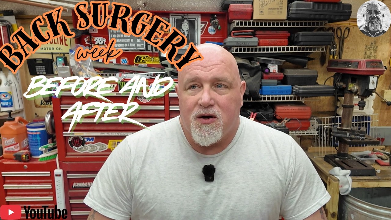Back Surgery L5–S1: My Honest Experience