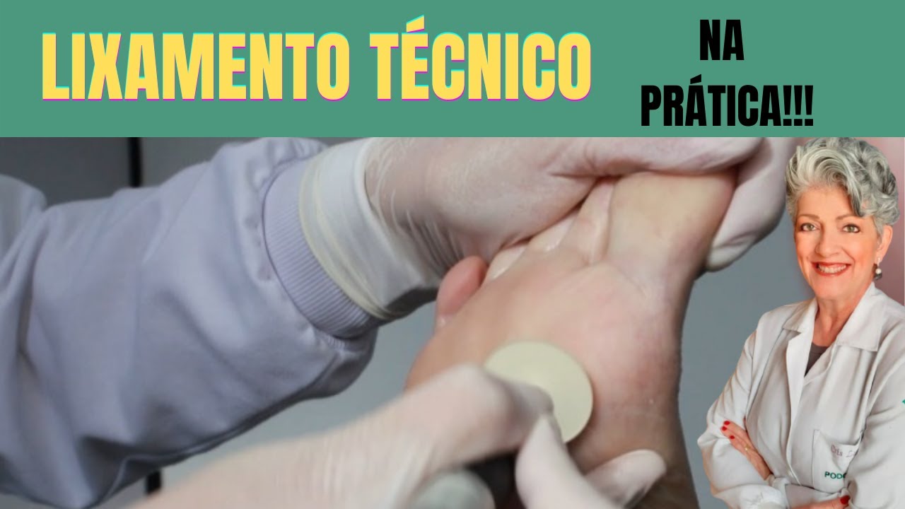 Aulão Como Realizar o Lixamento Técnico Corretamente