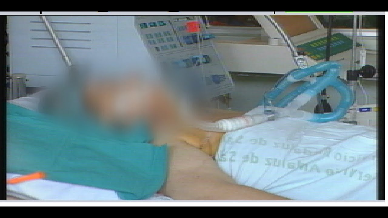 Hospital Reina Sofía de Córdoba: primer trasplante doble de pulmón de Andalucía