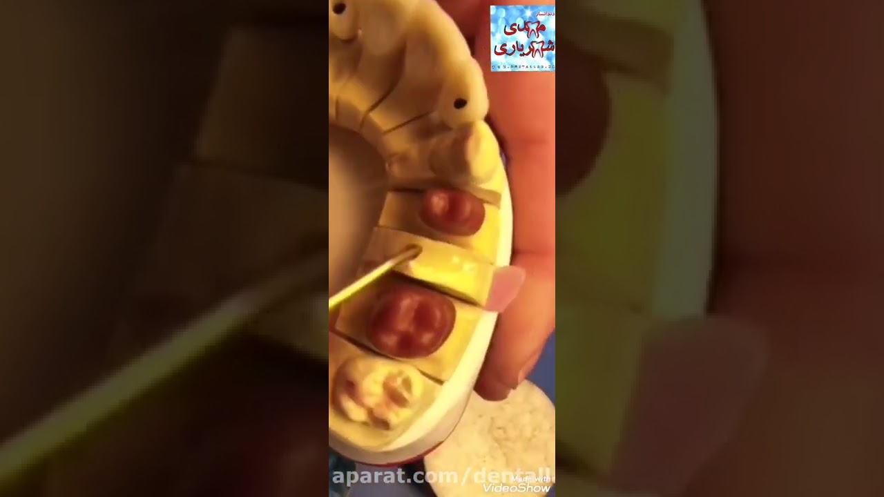 وکس اپ و پونتیک گذاری