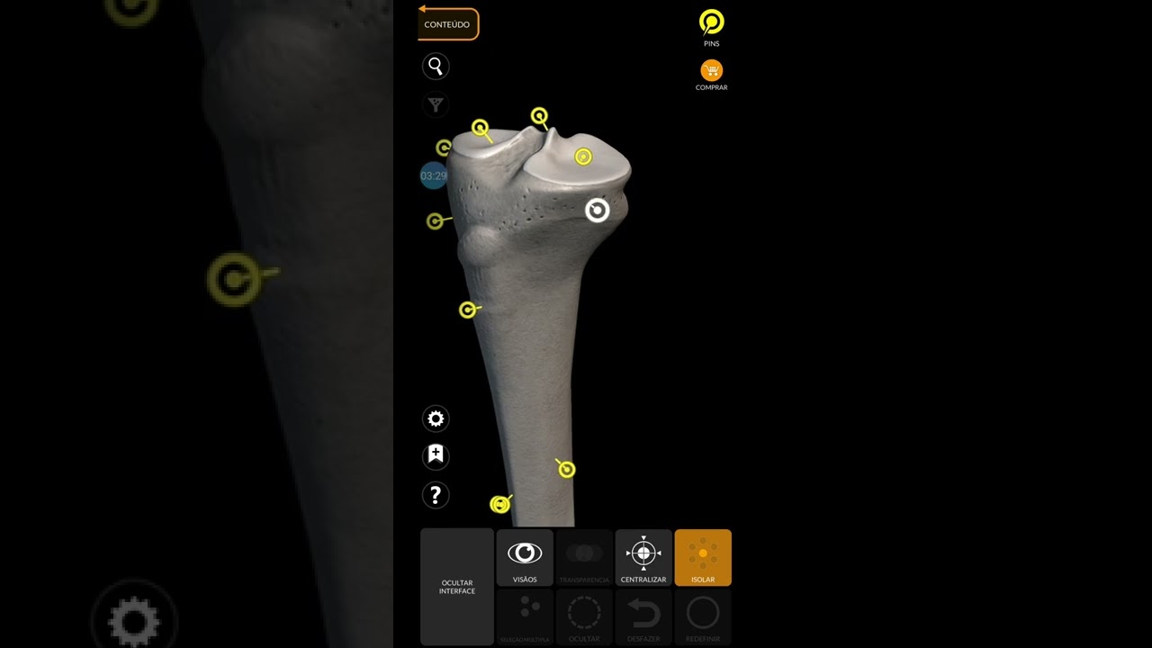 T&iacute;bia e Fibula: anatomia 1 Medicina Unicerrado