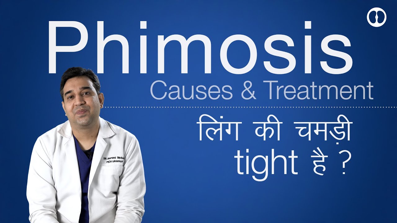 Phimosis causes and treatment | लिंग की चमड़ी टाइट होने के कारण और इलाज | टाइट फ्रेनुलम में फ़र्क