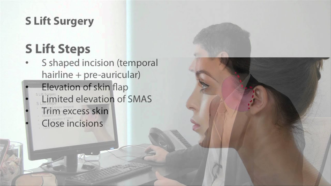 Part 10/13: S Lift Facelift Surgery | Face & Neck Rejuvenating Surgery with Dr. Buonassisi in BC