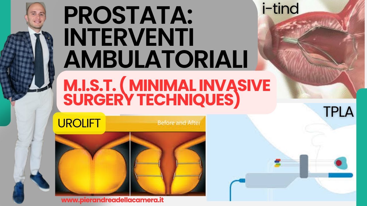Prostata: trattamenti ambulatoriali per la prostata ingrossata
