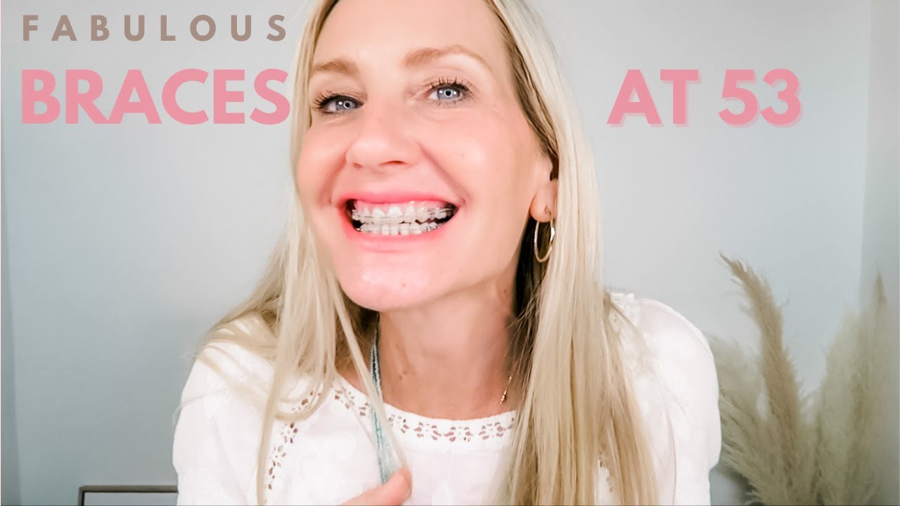 Getting Braces Over 50 Am I too Old For Braces?