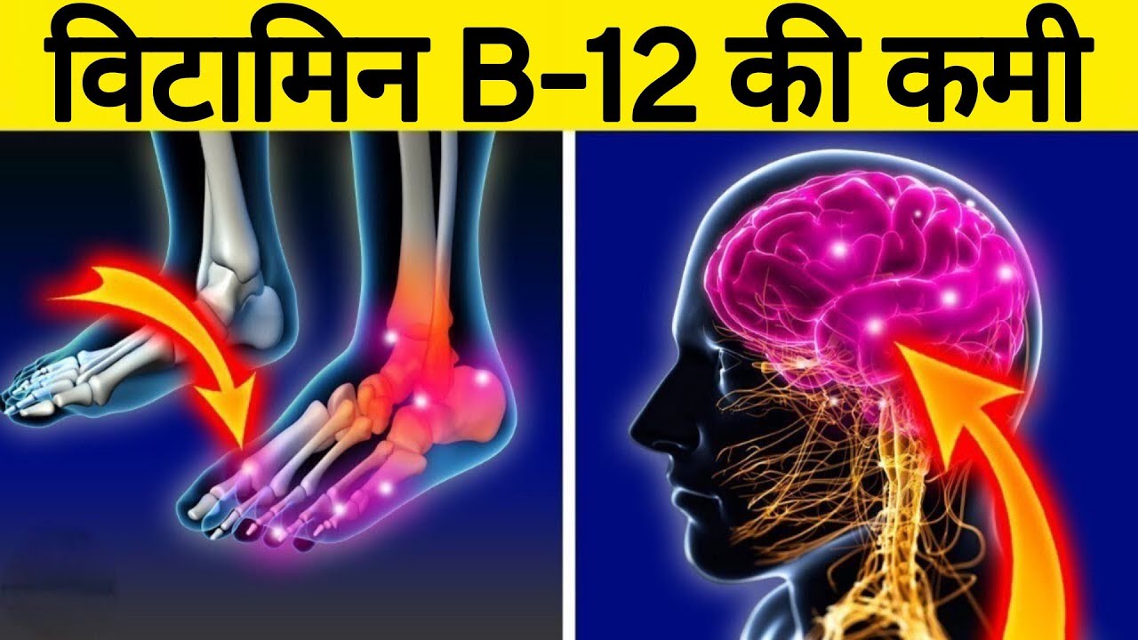 विटामिन B-12 की कमी को कैसे ठीक करे | Vitamin B-12 Deficiency