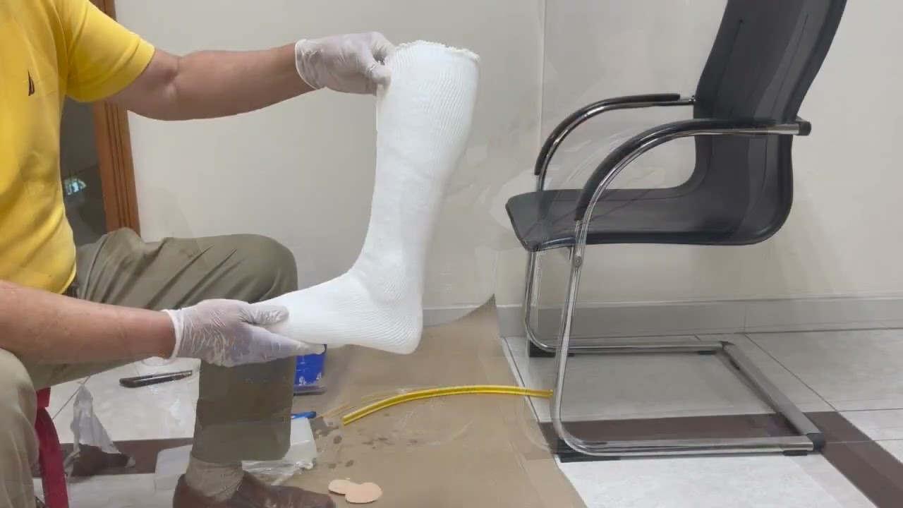 C Form Tube AFO Casting   Marlo Ortiz, CPO