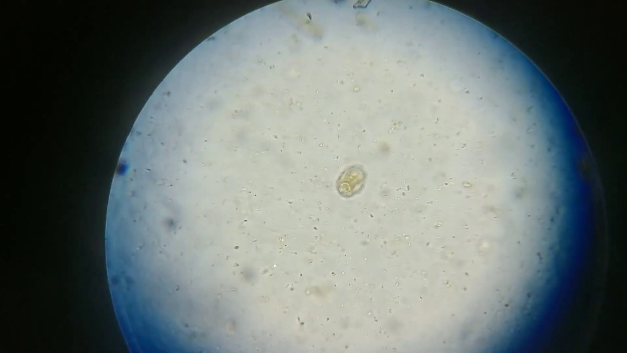 Running Fecal samples