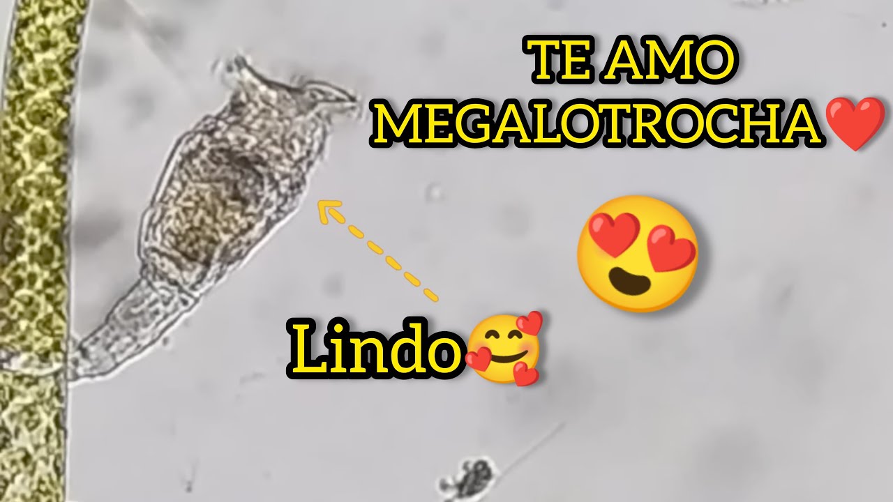 TE AMO MEGALOTROCHA❤️🔬