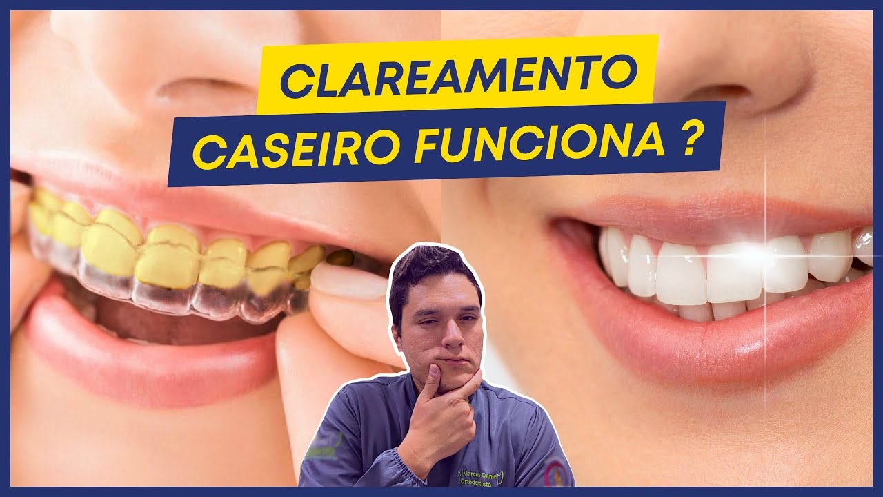 CLAREAMENTO DENTAL CASEIRO FUNCIONA?