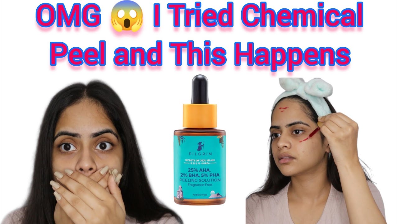 Pilgrim Peeling Solution Review | Watch This Before Using | Honest Review | Charul Gupta