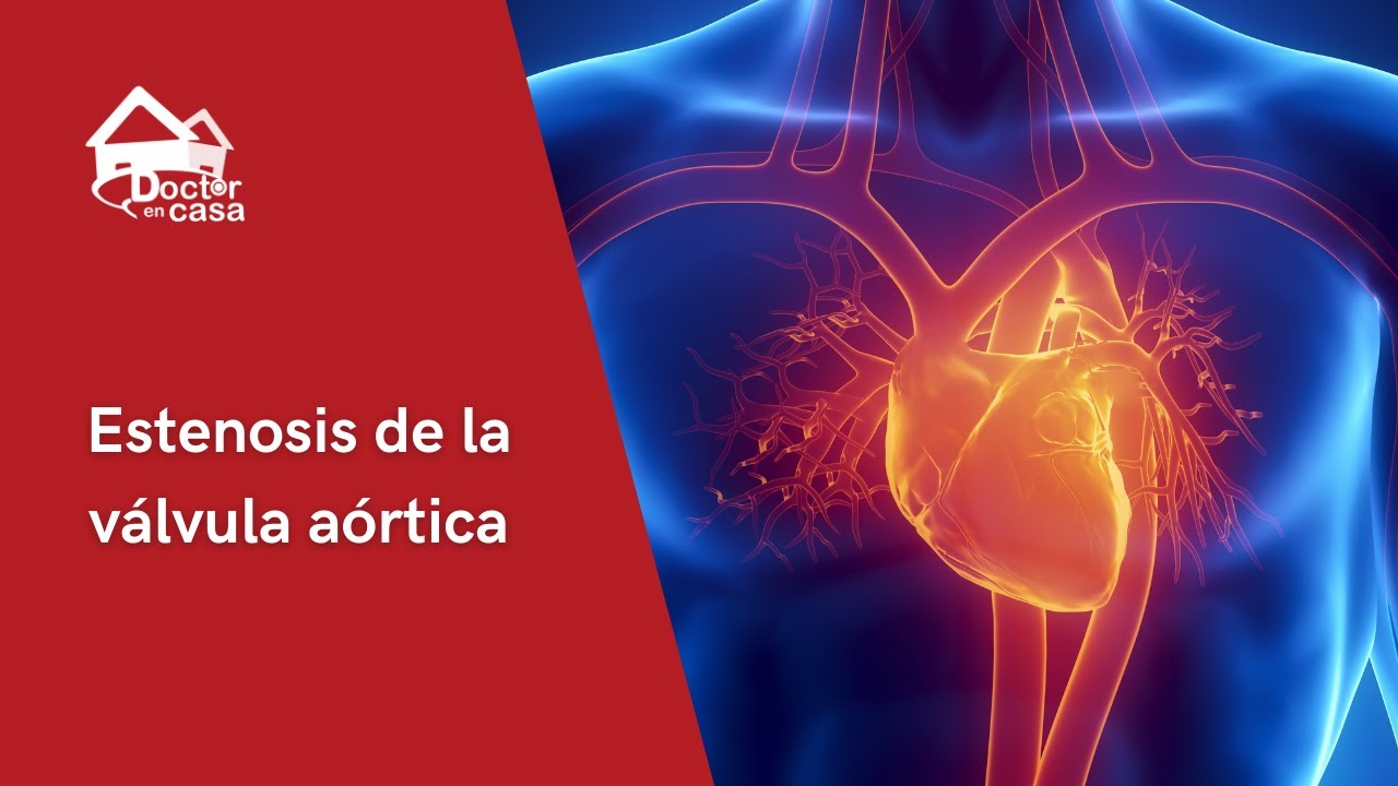 Estenosis de la válvula aortica