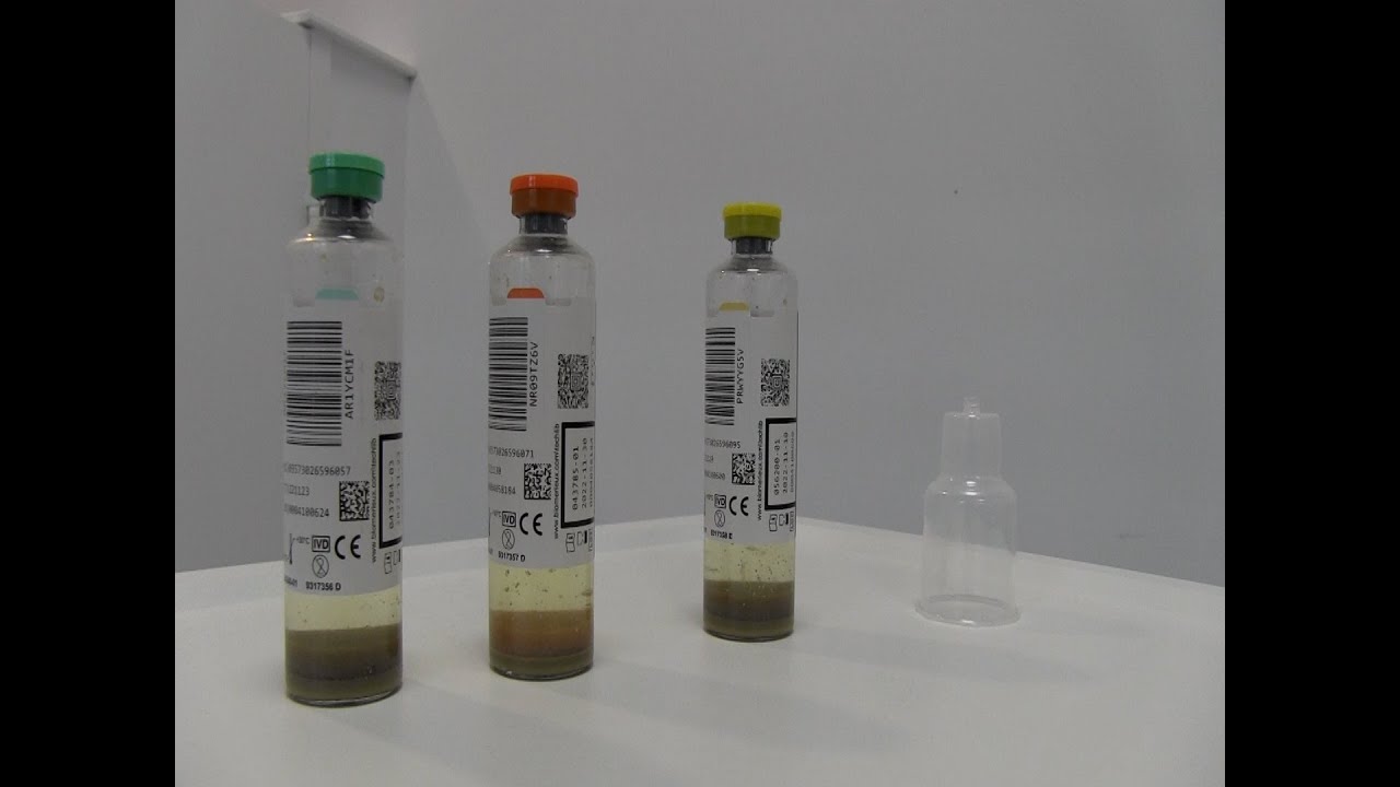 CHANGEMENT D'AUTOMATE D’HÉMOCULTURES: Quelles conséquences pour quel enjeu ?
