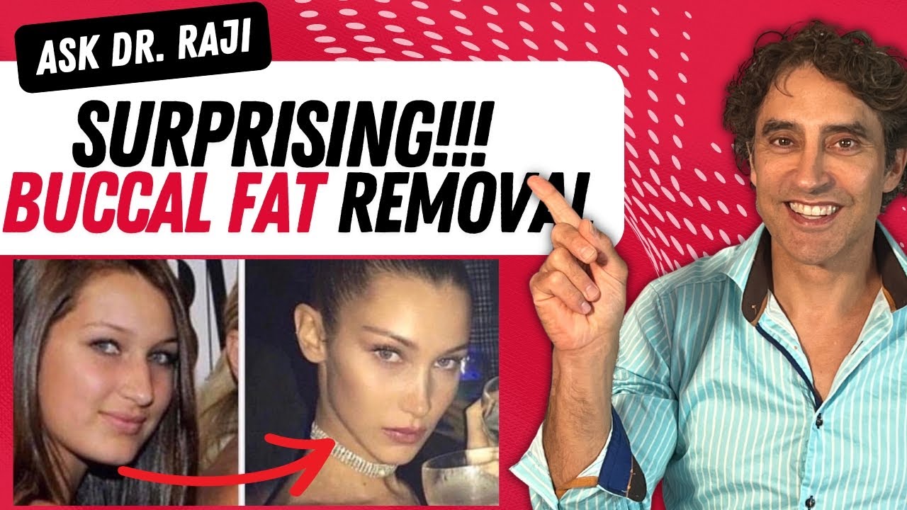 BUCCAL FAT REMOVAL DEMYSTIFIED //Buccal fat Removal