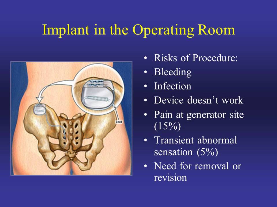 Advanced Treatments for Female Urinary Incontinence
