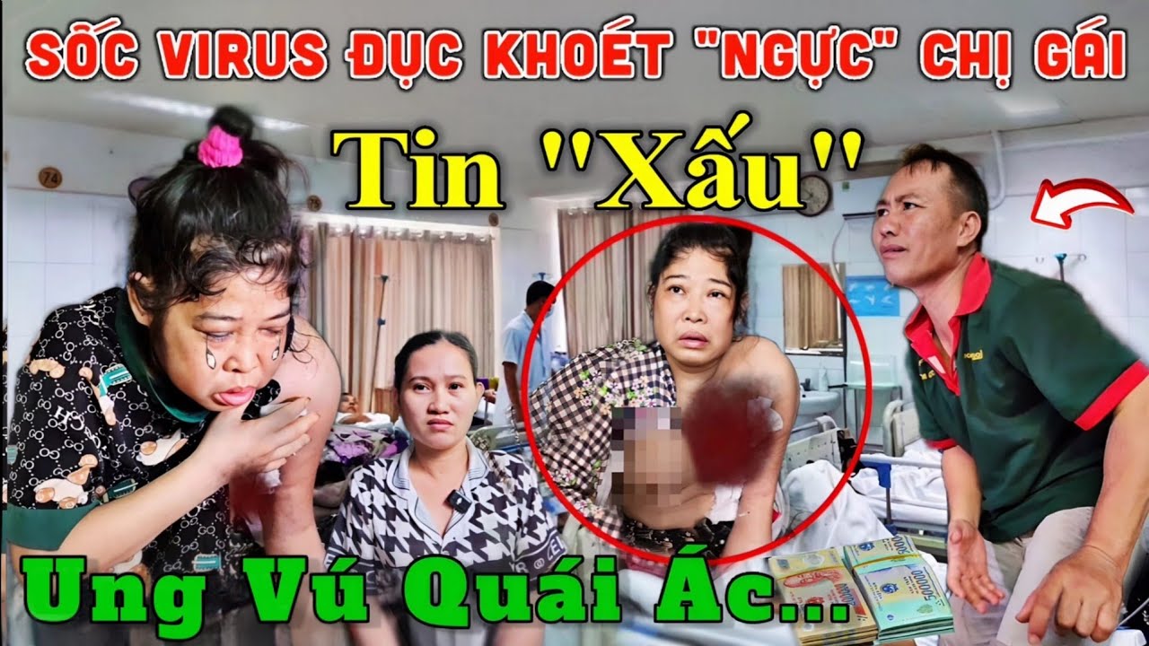 Sốc Virus Ăn Hết, Chị Gái Mắc Bệnh 